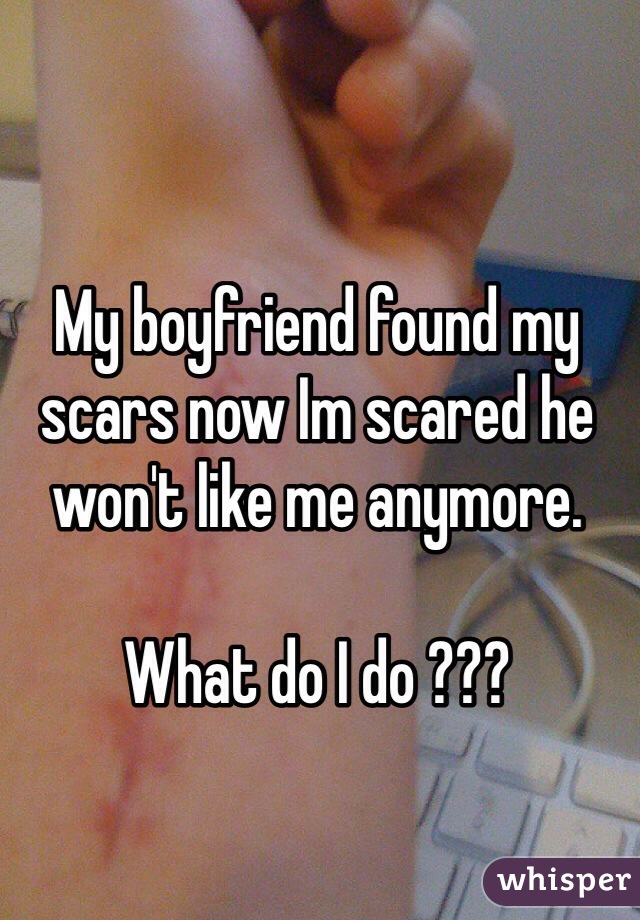 My boyfriend found my scars now Im scared he won't like me anymore. 

What do I do ??? 