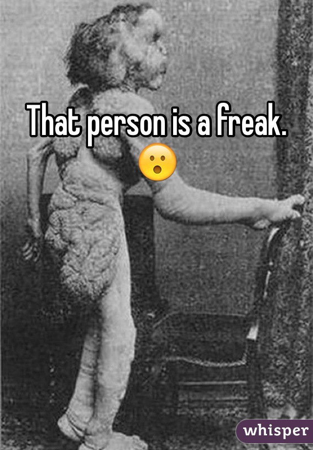 That person is a freak. 😮