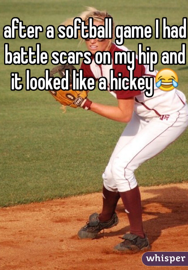 after a softball game I had battle scars on my hip and it looked like a hickey😂