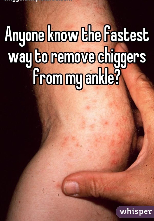 Anyone know the fastest way to remove chiggers from my ankle?