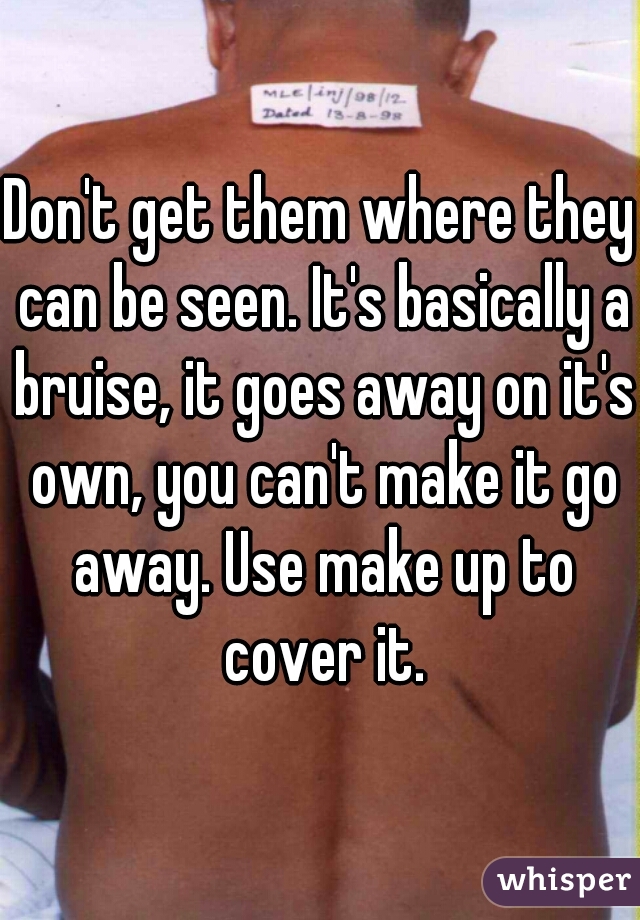 Don't get them where they can be seen. It's basically a bruise, it goes away on it's own, you can't make it go away. Use make up to cover it.