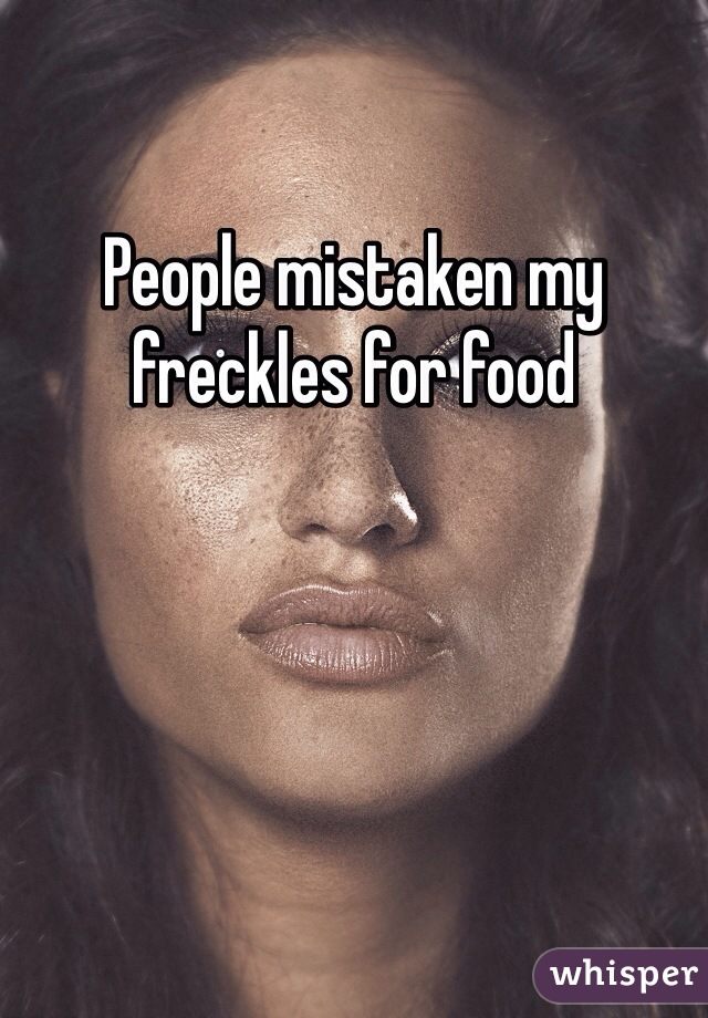 People mistaken my freckles for food