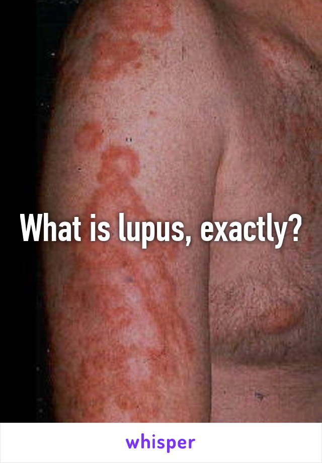 What is lupus, exactly?