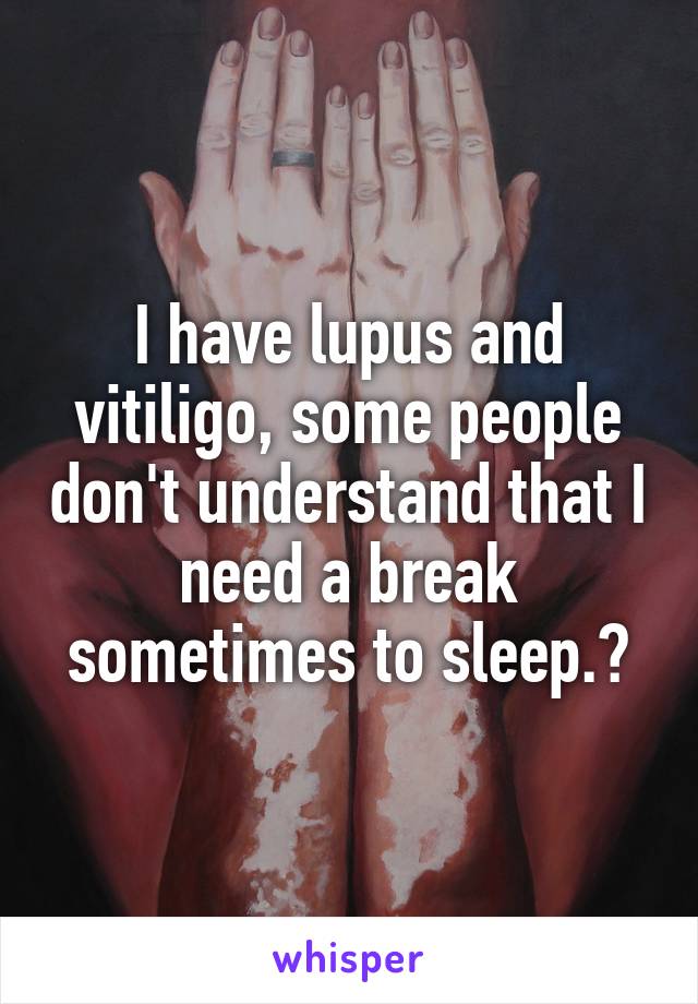 I have lupus and vitiligo, some people don't understand that I need a break sometimes to sleep.😔