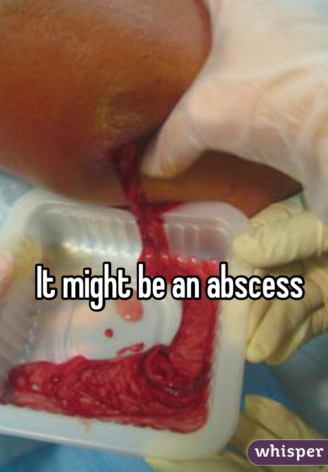 It might be an abscess