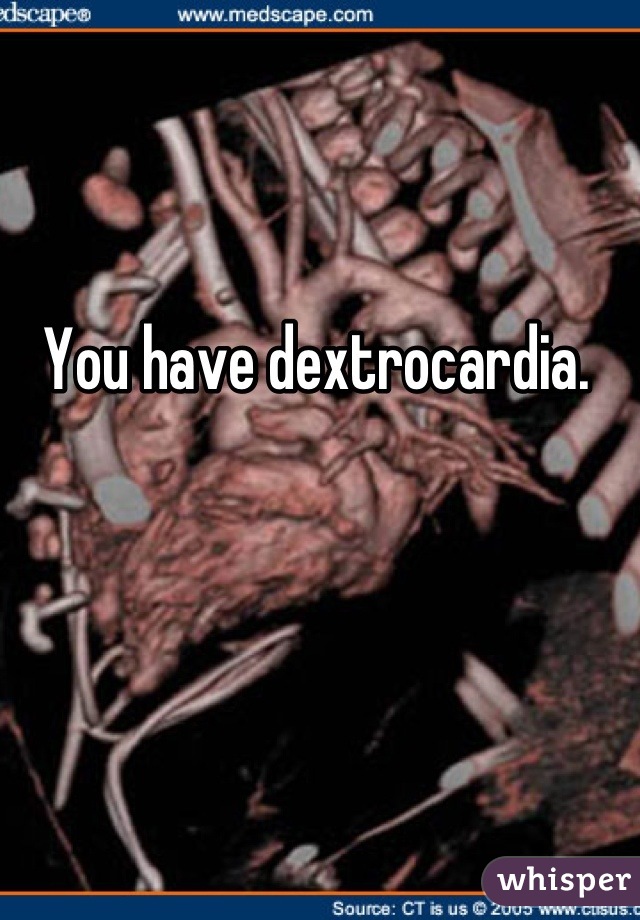 You have dextrocardia.