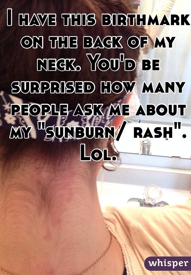 I have this birthmark on the back of my neck. You'd be surprised how many people ask me about my "sunburn/ rash". Lol.
