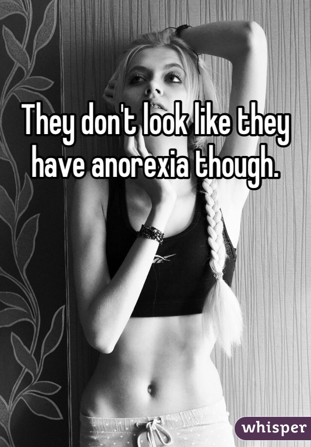 They don't look like they have anorexia though. 