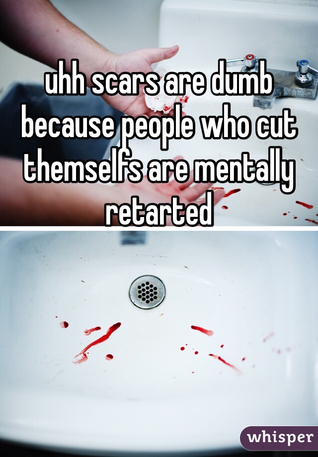 uhh scars are dumb because people who cut themselfs are mentally retarted