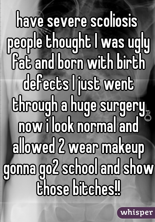 have severe scoliosis people thought I was ugly fat and born with birth defects I just went through a huge surgery now i look normal and allowed 2 wear makeup gonna go2 school and show those bitches!!