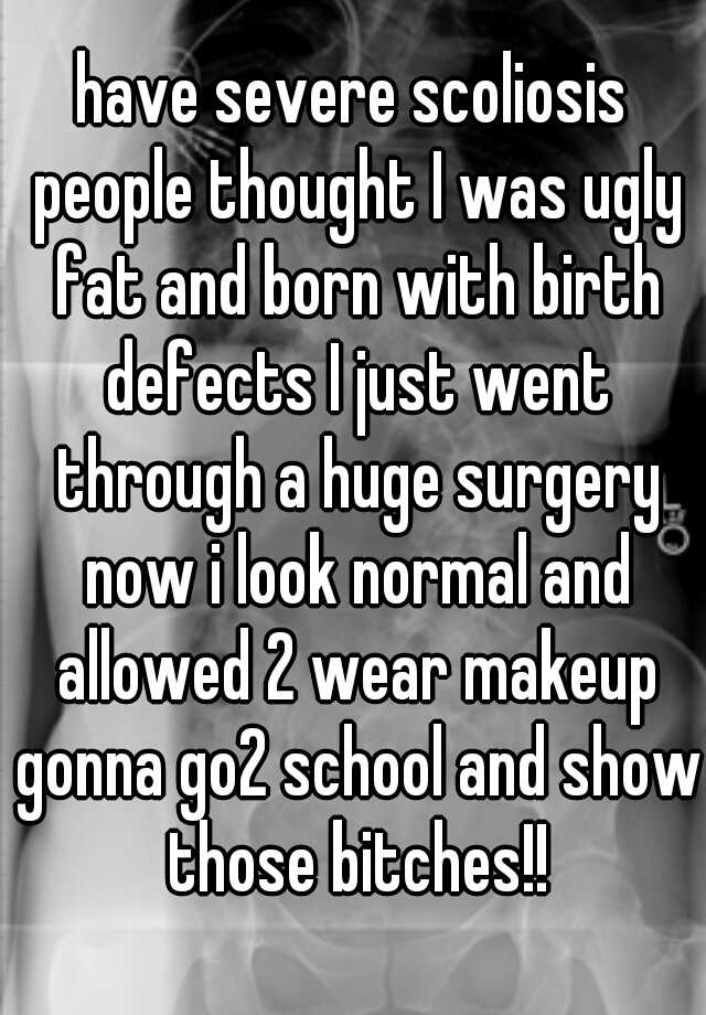 have severe scoliosis people thought I was ugly fat and born with birth defects I just went through a huge surgery now i look normal and allowed 2 wear makeup gonna go2 school and show those bitches!!