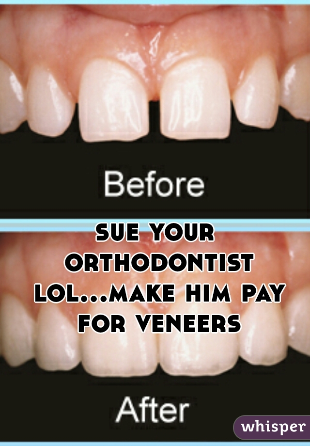 sue your orthodontist lol...make him pay for veneers