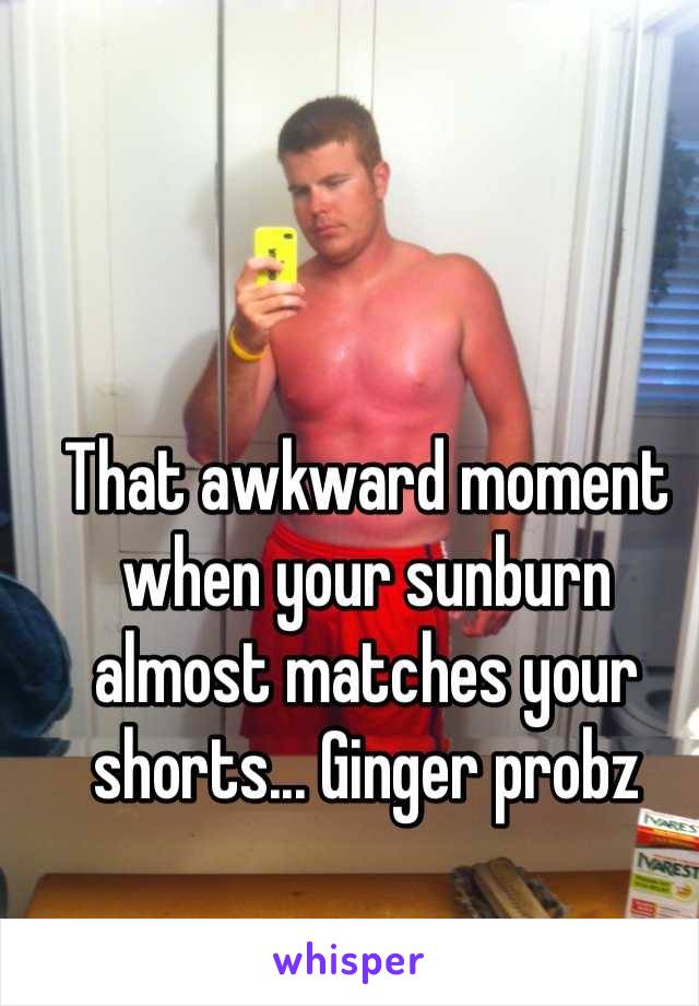 That awkward moment when your sunburn almost matches your shorts... Ginger probz