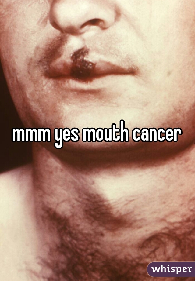 mmm yes mouth cancer