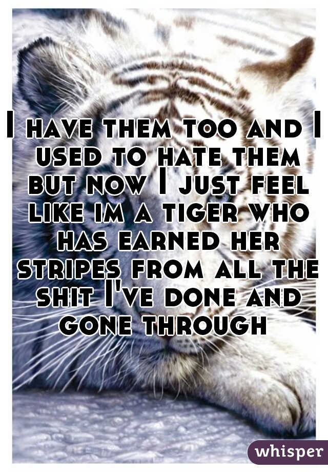I have them too and I used to hate them but now I just feel like im a tiger who has earned her stripes from all the shit I've done and gone through 