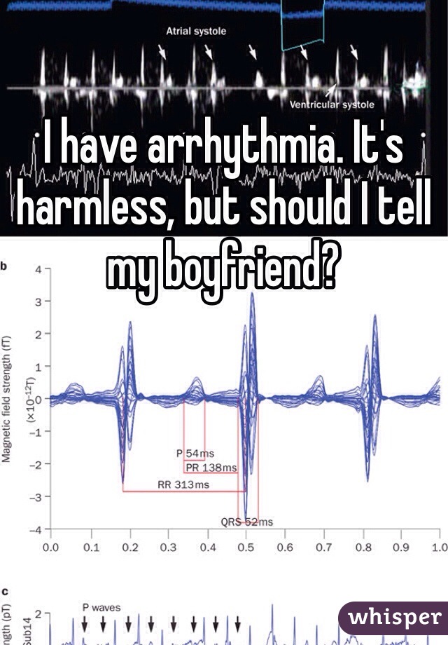 I have arrhythmia. It's harmless, but should I tell my boyfriend? 