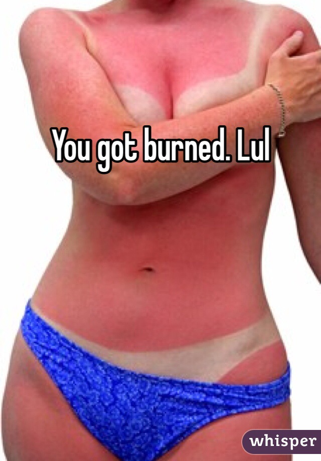 You got burned. Lul