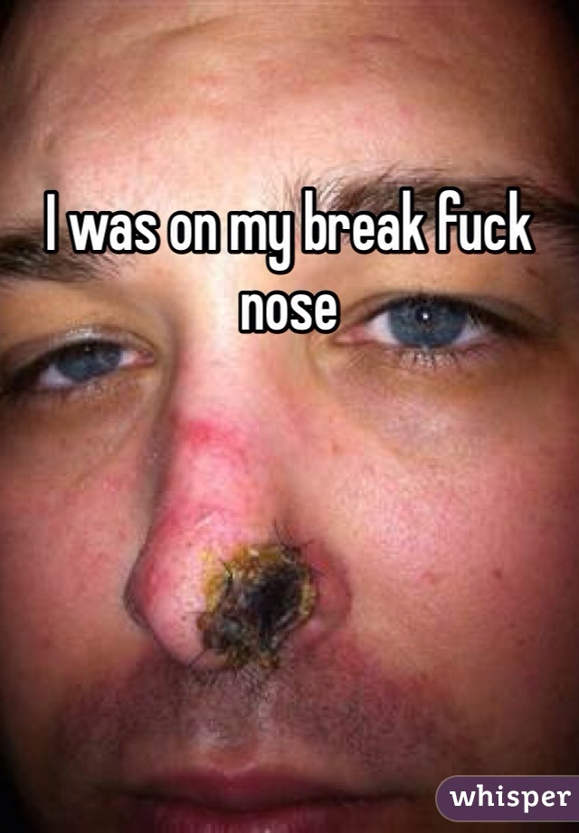 I was on my break fuck nose