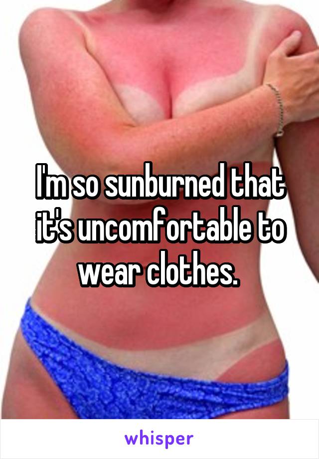 I'm so sunburned that it's uncomfortable to wear clothes. 