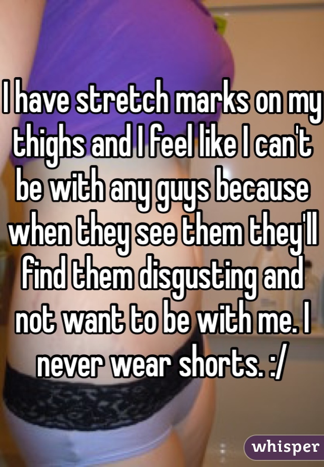 I have stretch marks on my thighs and I feel like I can't be with any guys because when they see them they'll find them disgusting and not want to be with me. I never wear shorts. :/