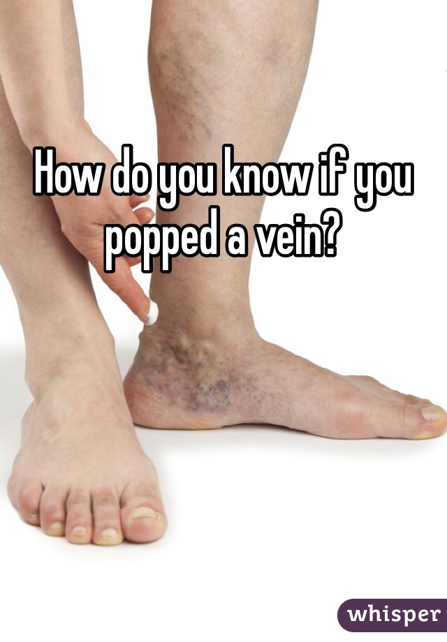 How do you know if you popped a vein?