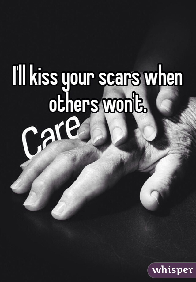 I'll kiss your scars when others won't.