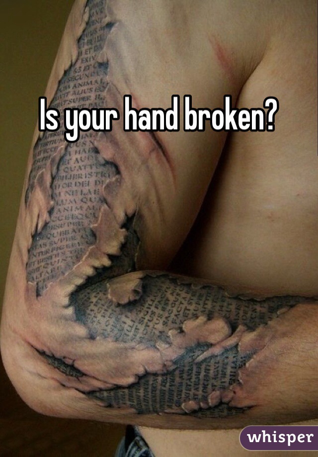 Is your hand broken?