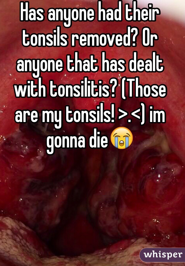 Has anyone had their tonsils removed? Or anyone that has dealt with tonsilitis? (Those are my tonsils! >.<) im gonna die😭