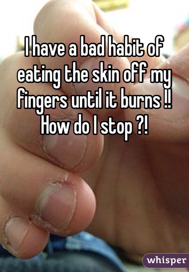 I have a bad habit of eating the skin off my fingers until it burns !! How do I stop ?!
