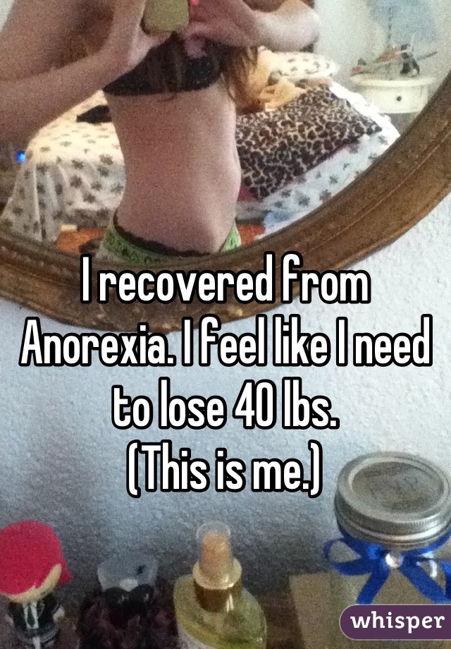 



I recovered from Anorexia. I feel like I need to lose 40 lbs. 
(This is me.)