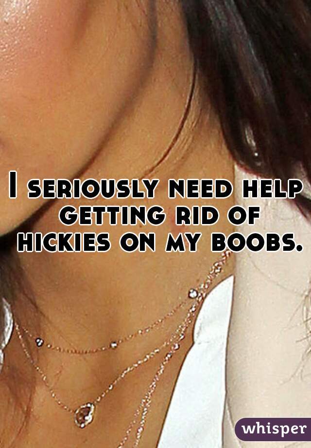 I seriously need help getting rid of hickies on my boobs.
