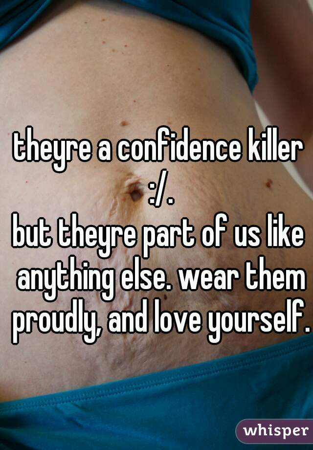 theyre a confidence killer :/.
but theyre part of us like anything else. wear them proudly, and love yourself.