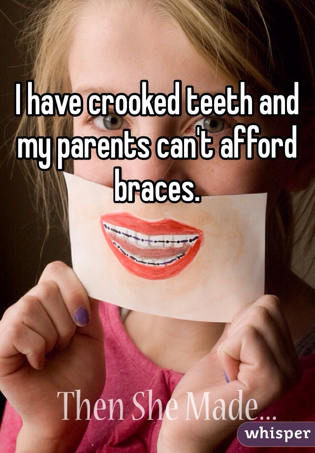 I have crooked teeth and my parents can't afford braces. 