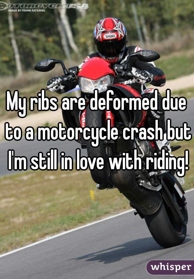 My ribs are deformed due to a motorcycle crash but I'm still in love with riding!