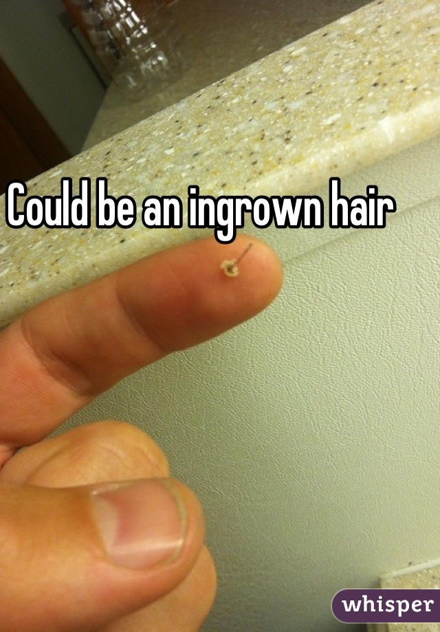 Could be an ingrown hair