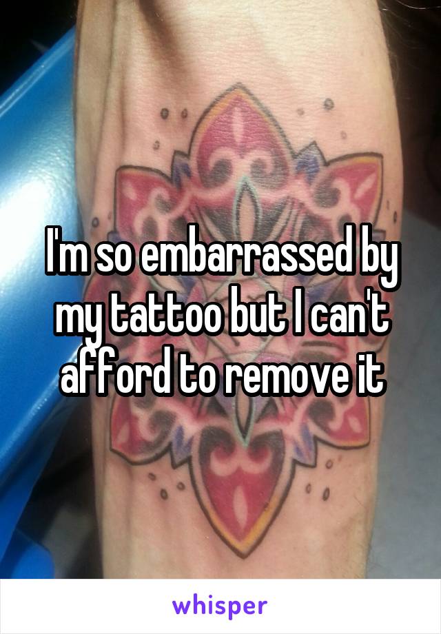 I'm so embarrassed by my tattoo but I can't afford to remove it
