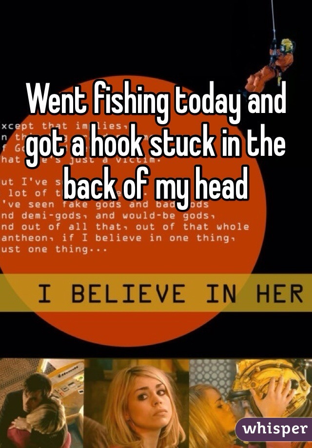 Went fishing today and got a hook stuck in the back of my head