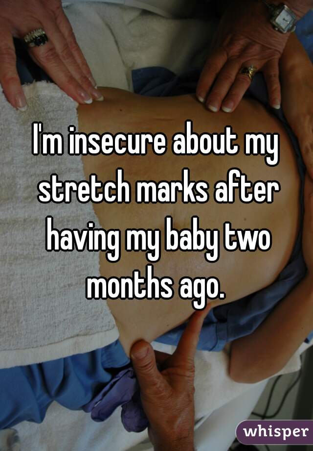 I'm insecure about my stretch marks after having my baby two months ago. 