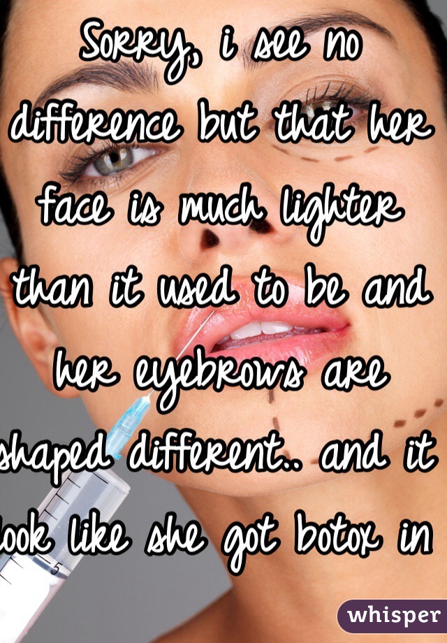 Sorry, i see no difference but that her face is much lighter than it used to be and her eyebrows are shaped different.. and it look like she got botox in her cheeks and plus age but we can agree to disagree 