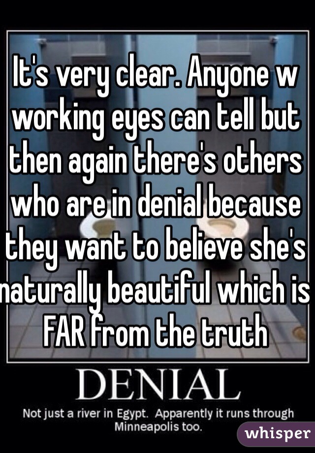 It's very clear. Anyone w working eyes can tell but then again there's others who are in denial because they want to believe she's naturally beautiful which is FAR from the truth