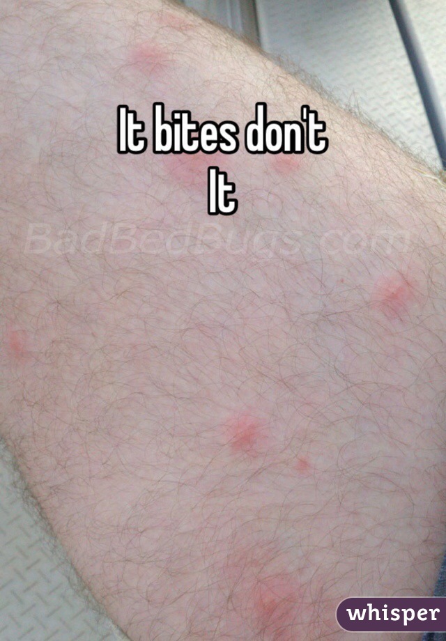 It bites don't
It  