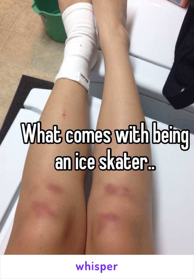 What comes with being an ice skater..