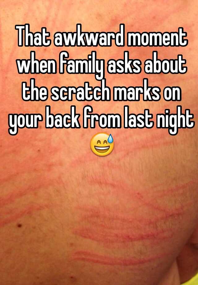 that-awkward-moment-when-family-asks-about-the-scratch-marks-on-your