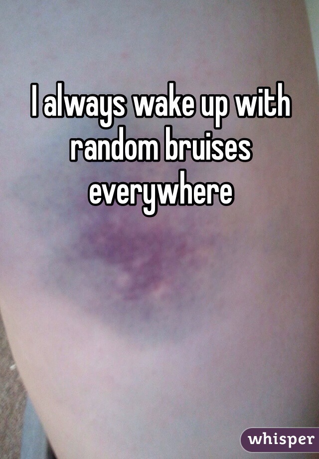 I always wake up with random bruises everywhere