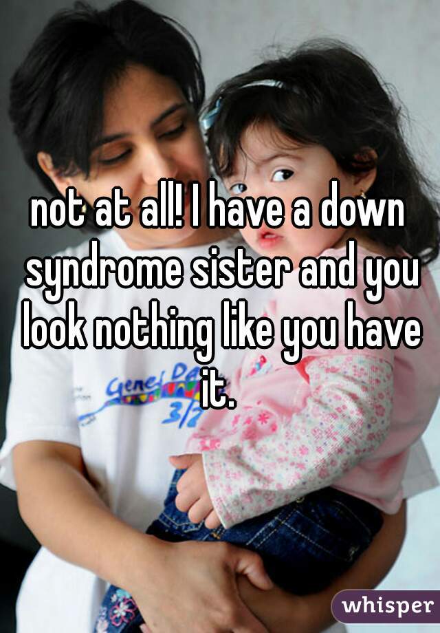 not at all! I have a down syndrome sister and you look nothing like you have it. 