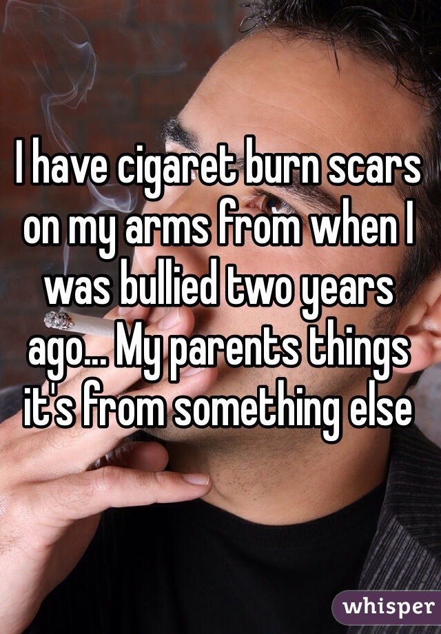 I have cigaret burn scars on my arms from when I was bullied two years ago... My parents things it's from something else 