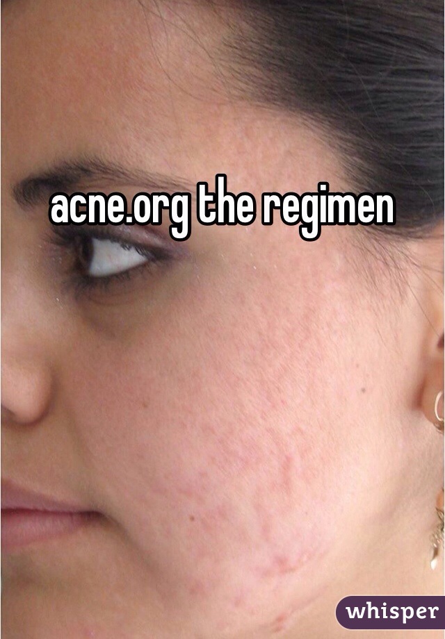 acne.org the regimen