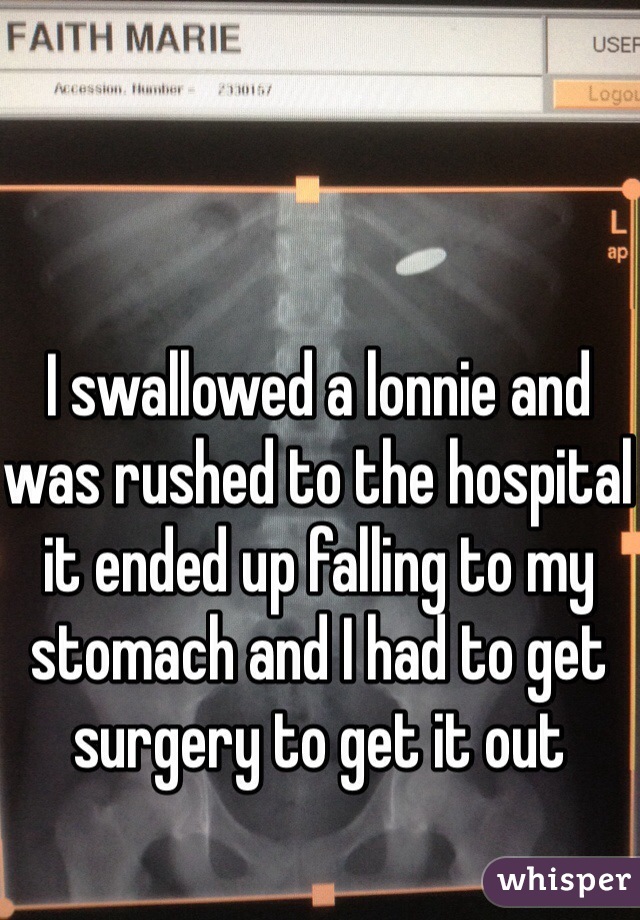 I swallowed a lonnie and was rushed to the hospital it ended up falling to my stomach and I had to get surgery to get it out 