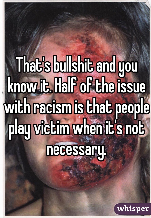 That's bullshit and you know it. Half of the issue with racism is that people play victim when it's not necessary.