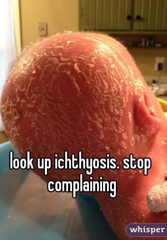 look up ichthyosis. stop complaining